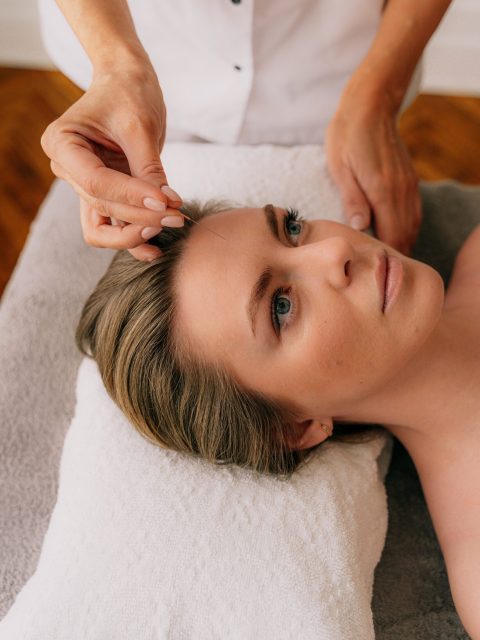 An acupuncturist applying an acupuncture needle to a client's forehead. Acupuncture in Cheshire.